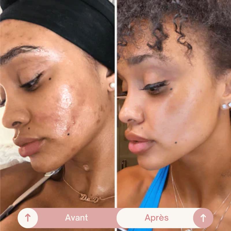 🌟 Masque Peel-Off au Collagène - Révélez Votre Peau Éclatante ! 🌟